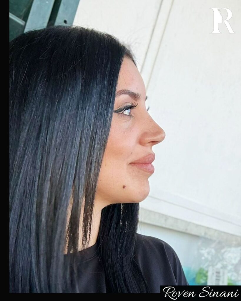 Natural results
