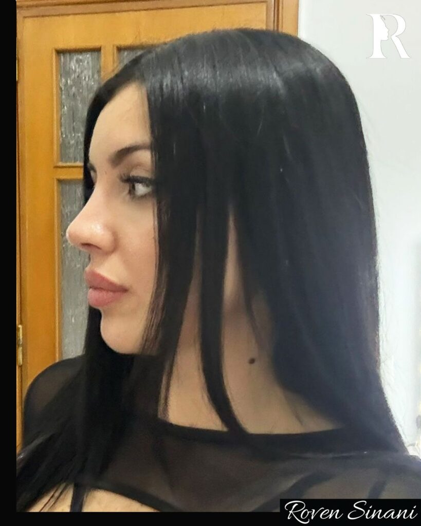 Natural results