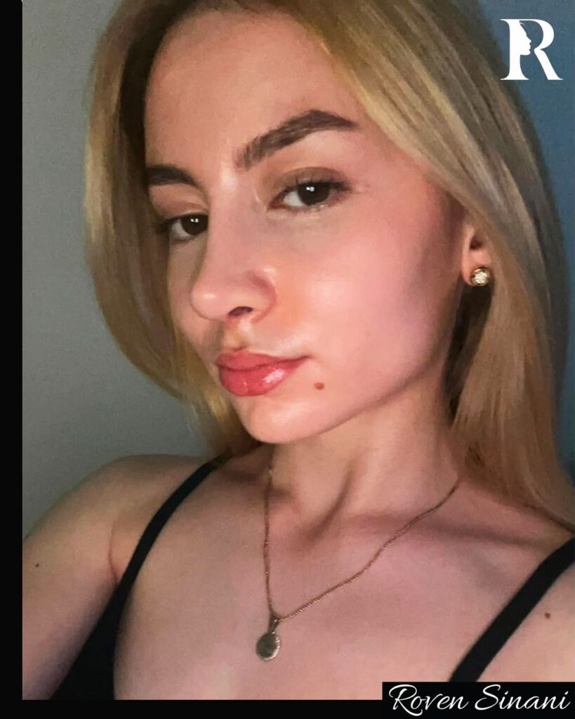 Natural results