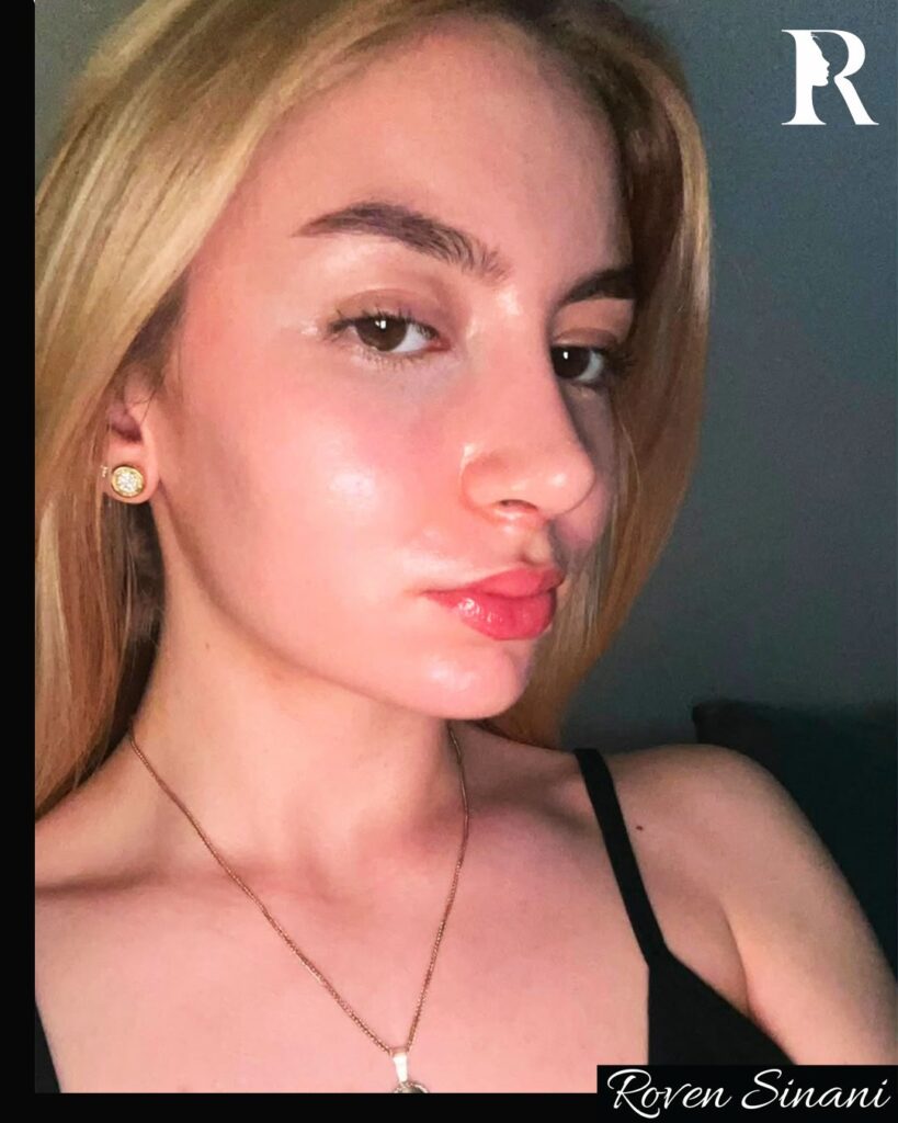 Natural results