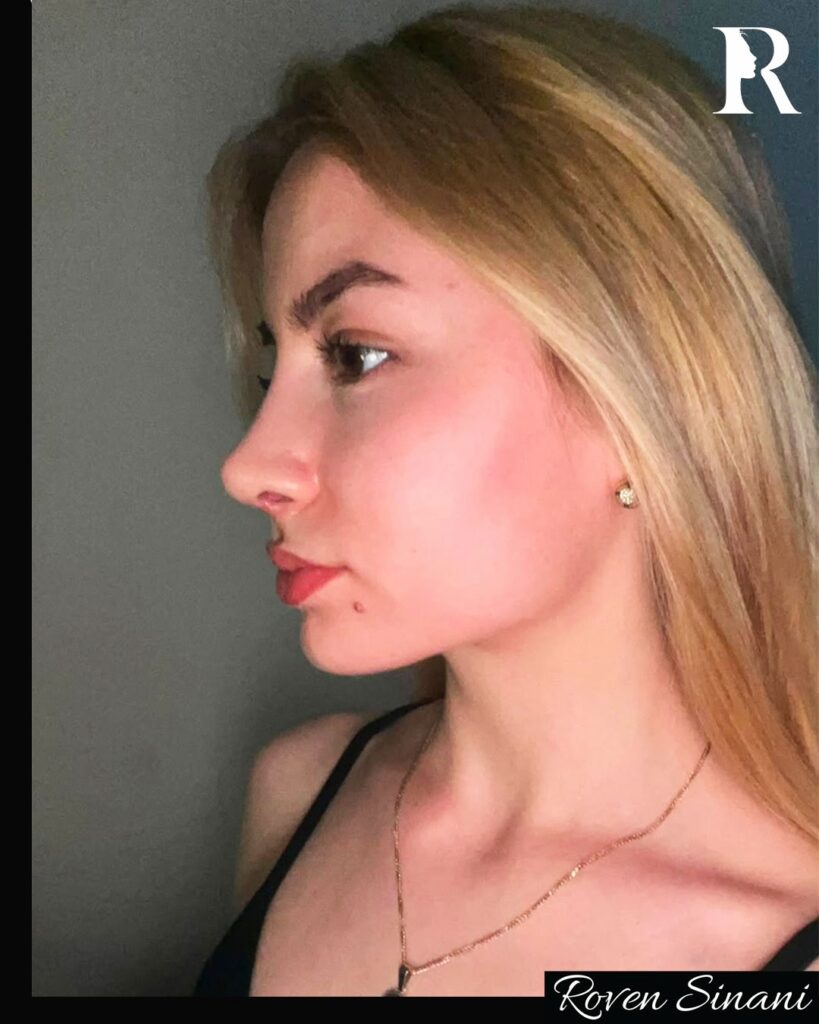 Natural results