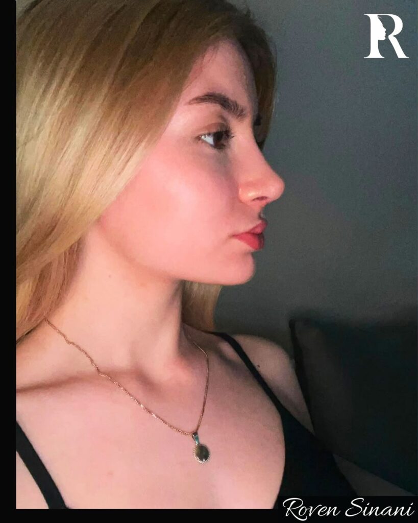Natural results